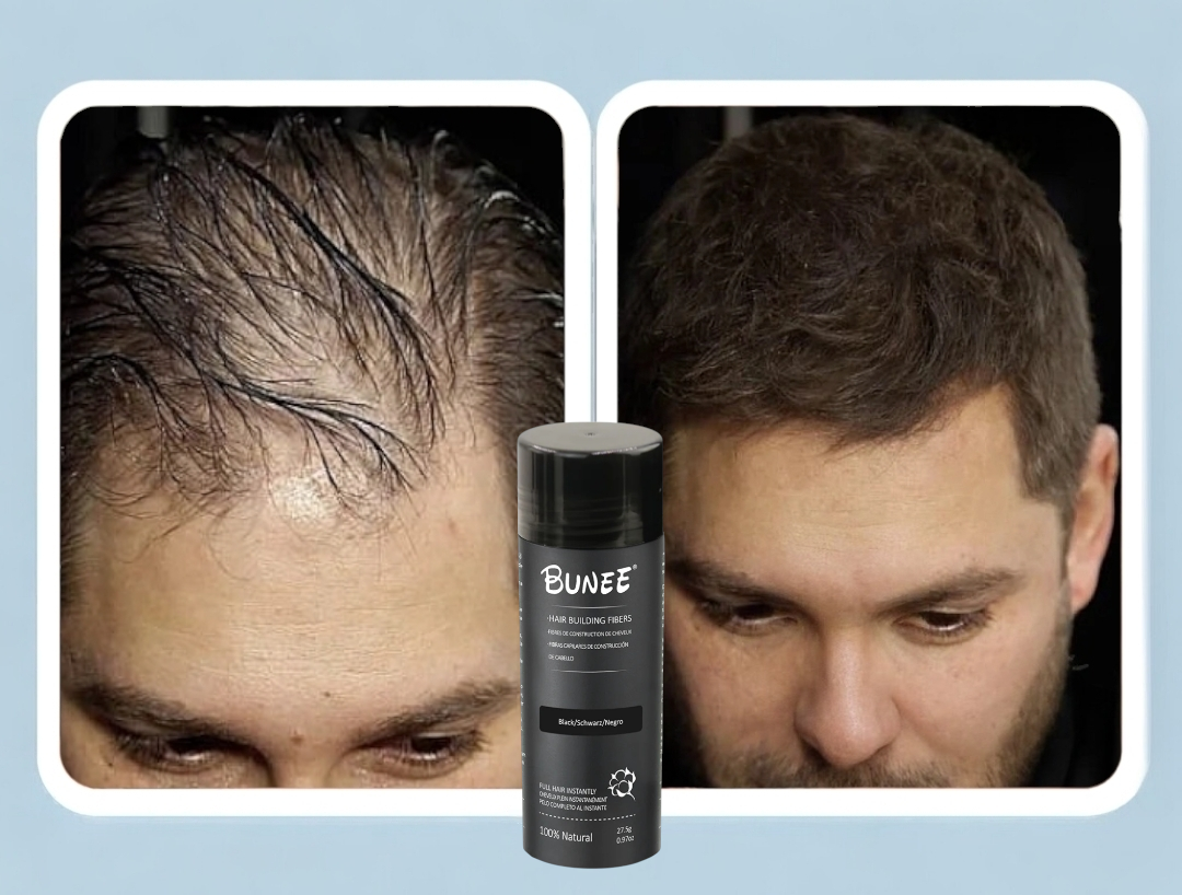 BUNEE