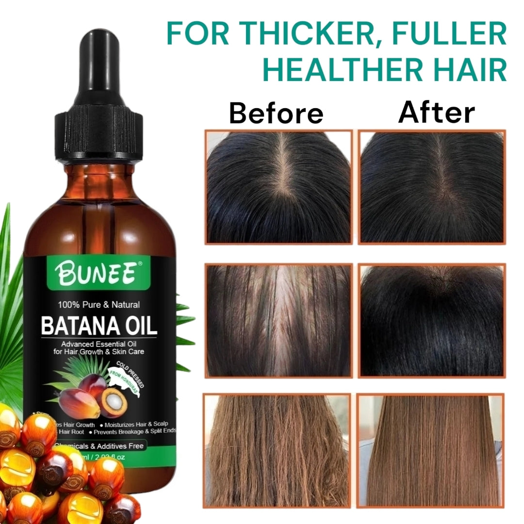BUNEE® Batana Oil – Hair Growth Serum