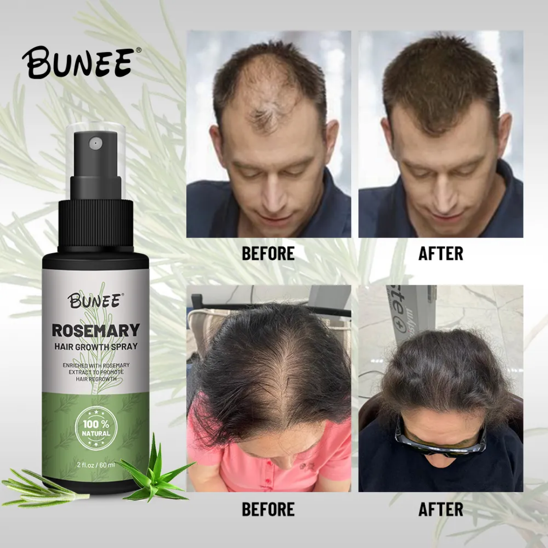 BUNEE® Hair Growth Spray