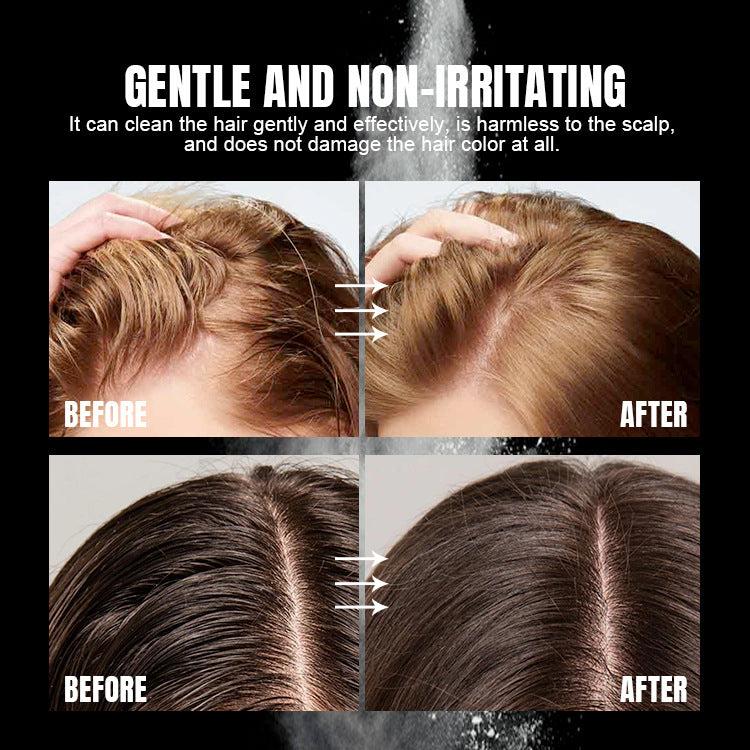 BUNEE® Dry Shampoo Powder