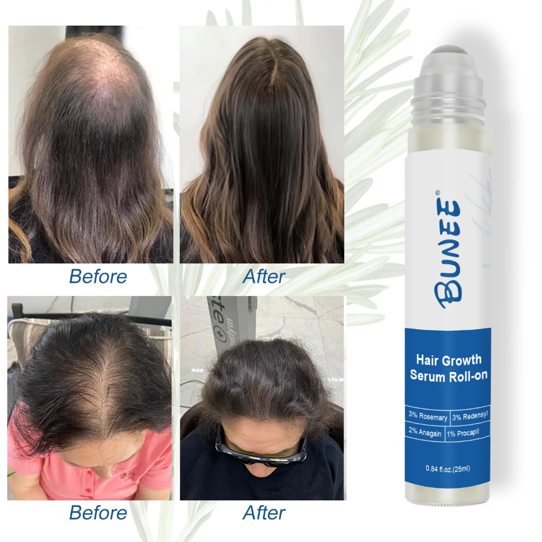 BUNEE® Growth Serum Roll-On