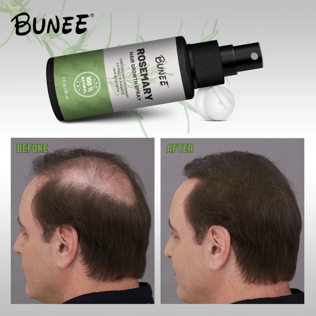 BUNEE® Hair Growth Spray