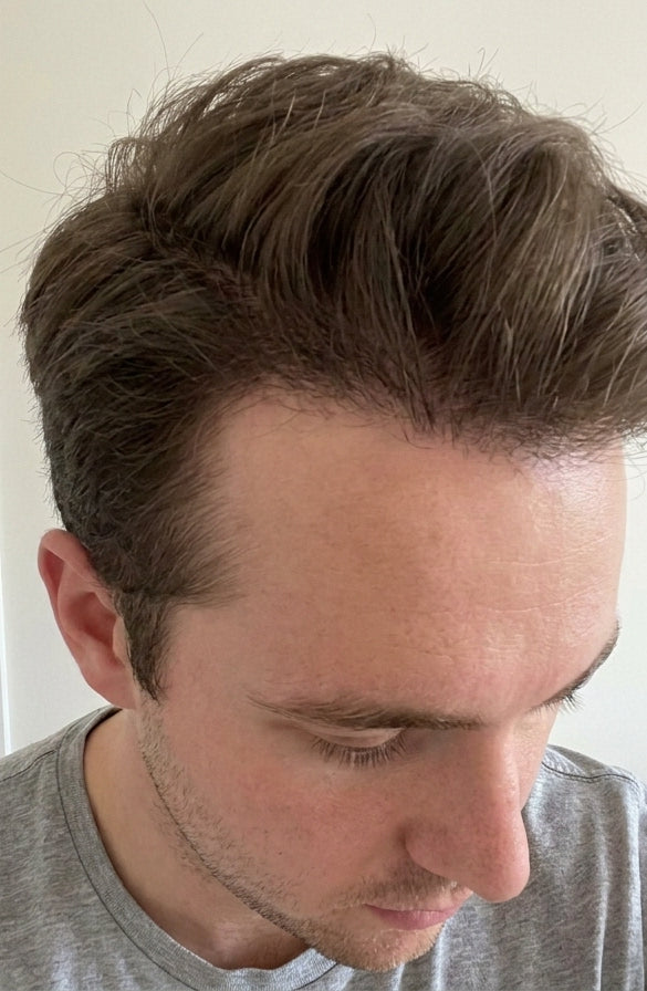 After
