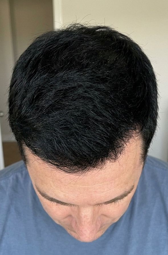 After