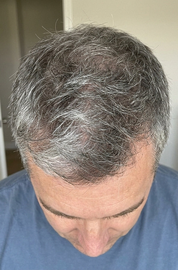 Before