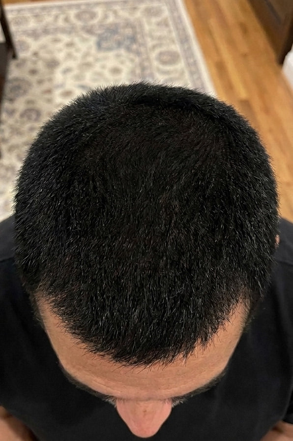 After