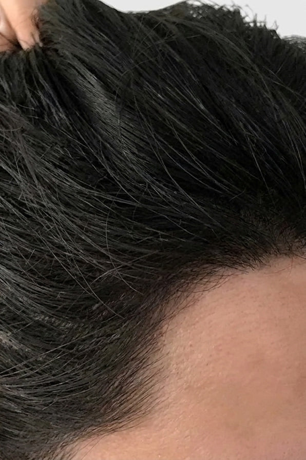 After