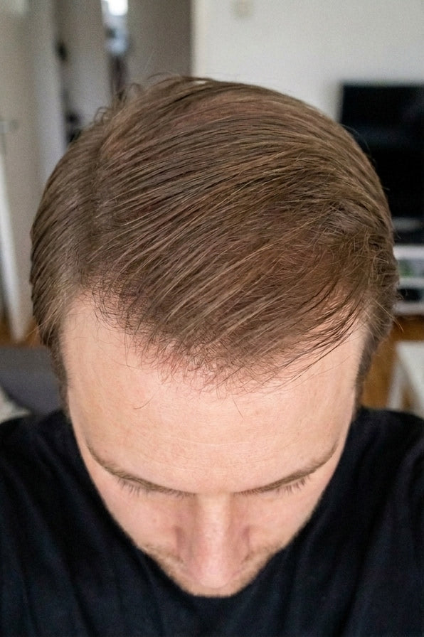 Before