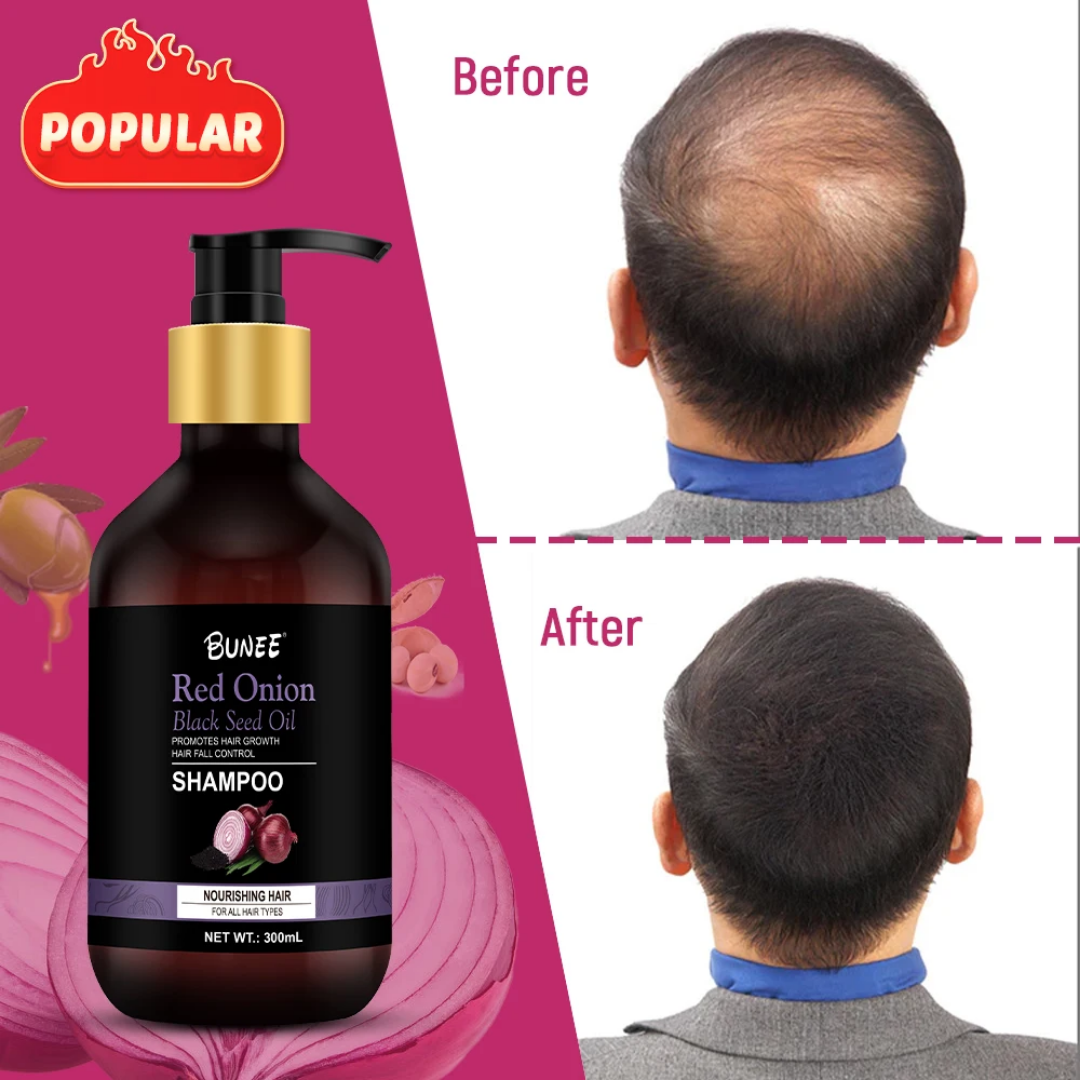 BUNEE® Hair Growth Shampoo