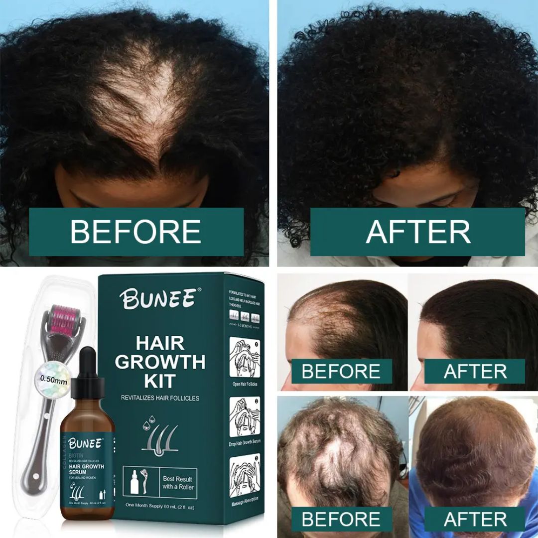 Hair Growth Serum & Derma Roll