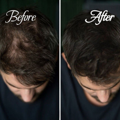 BUNEE® Hairline Powder