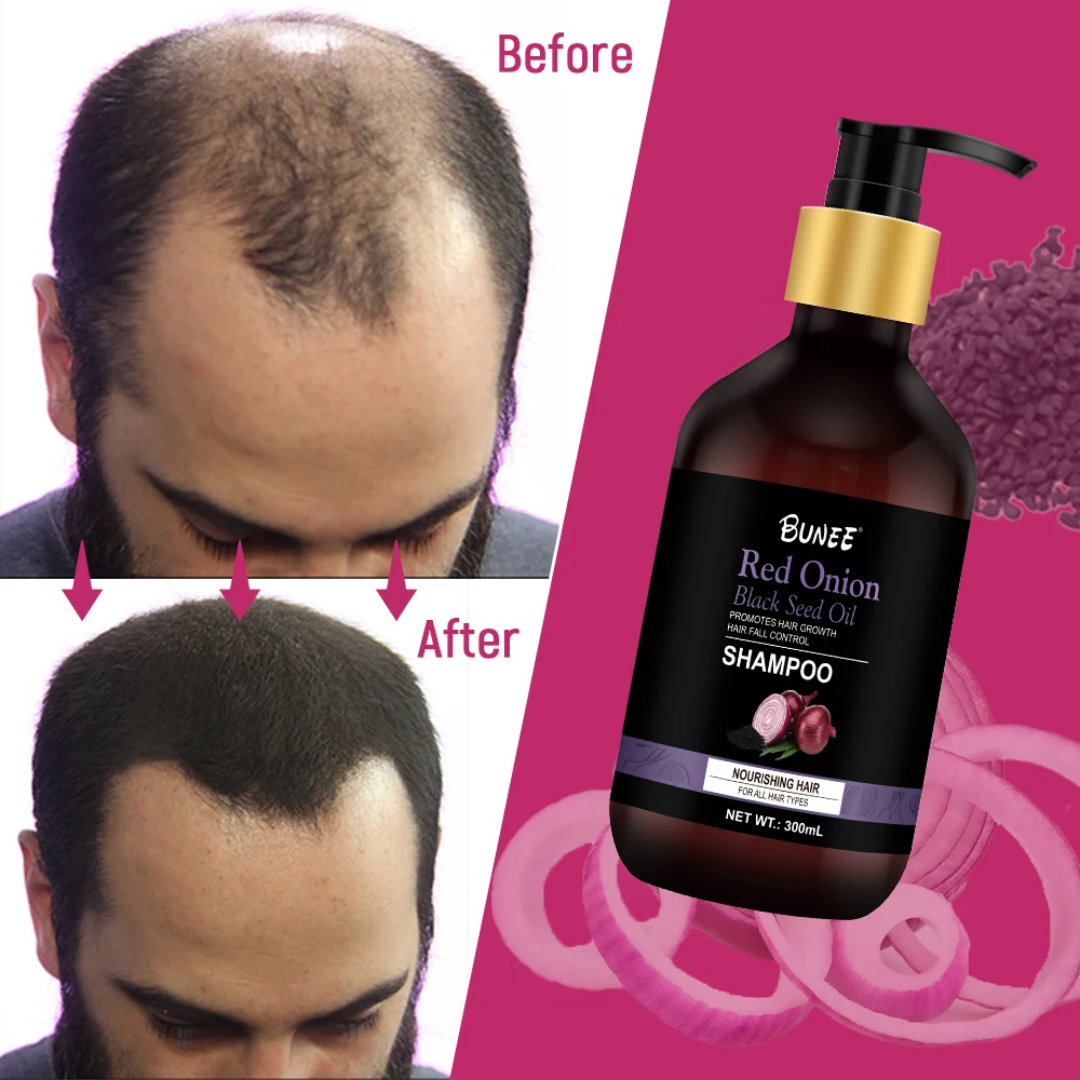 BUNEE® Hair Growth Shampoo