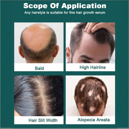 Hair Growth Serum