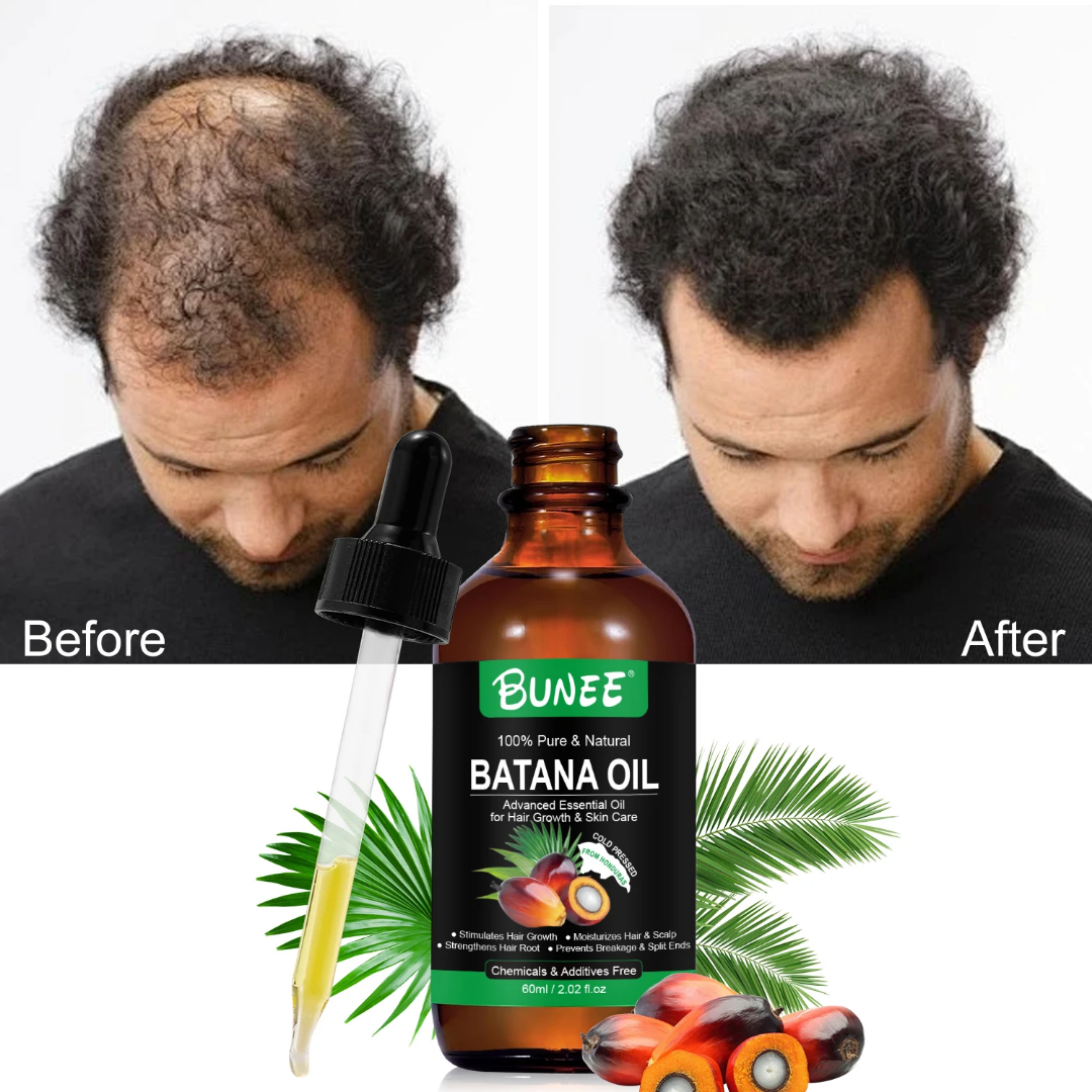 BUNEE® Batana Oil – Hair Growth Serum