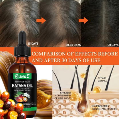 BUNEE® Batana Oil – Hair Growth Serum