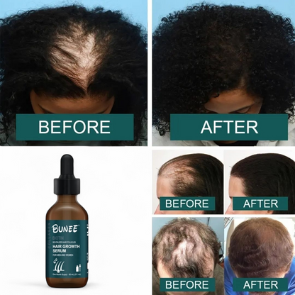 Hair Growth Serum