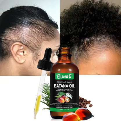 BUNEE® Batana Oil – Hair Growth Serum