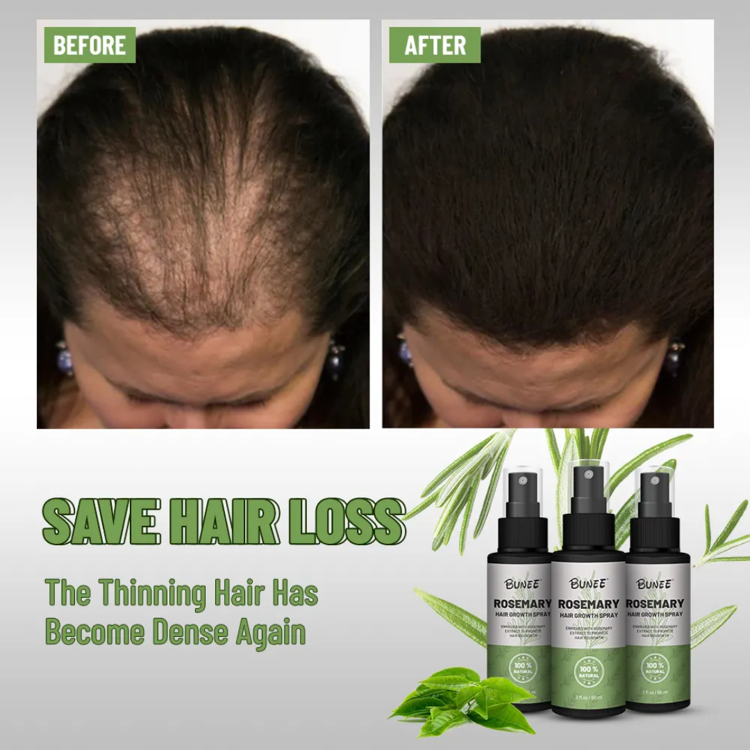 BUNEE® Hair Growth Spray
