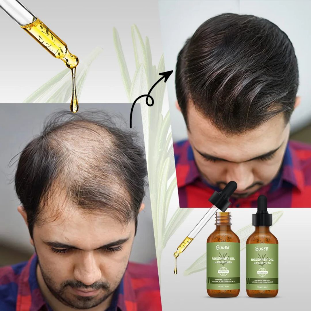 BUNEE® Hair Growth Serum