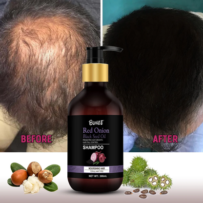 BUNEE® Hair Growth Shampoo