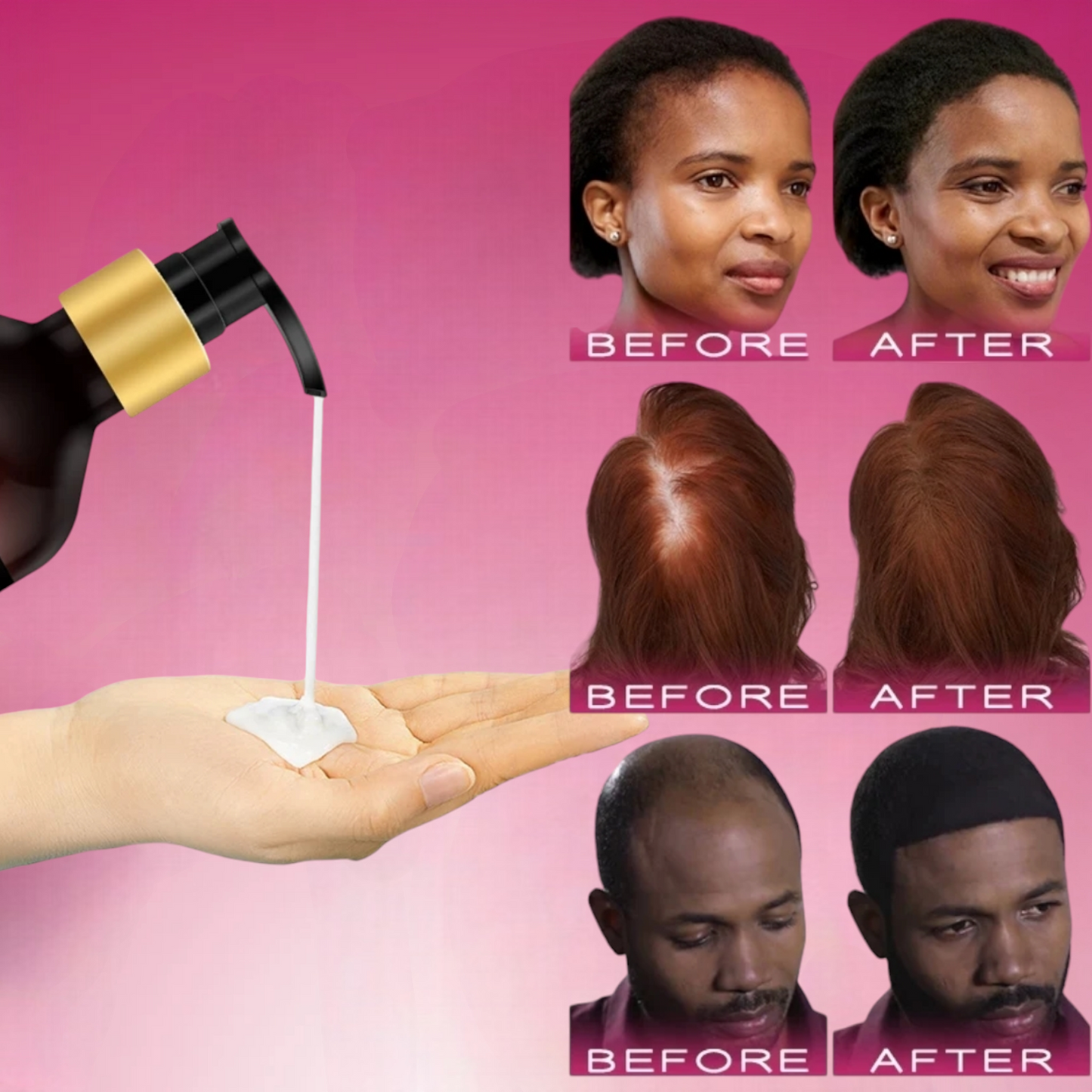 BUNEE® Hair Growth Shampoo