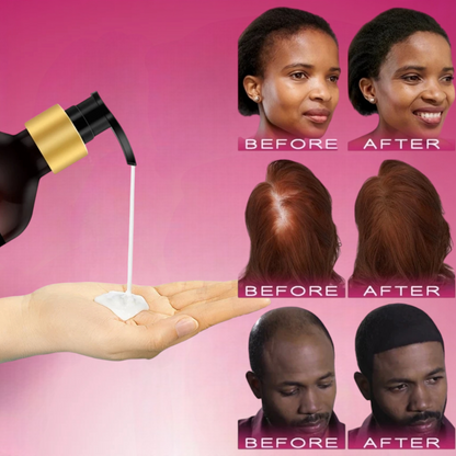 BUNEE® Hair Growth Shampoo