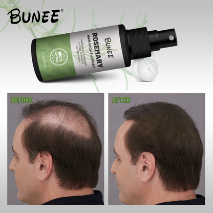 BUNEE® Hair Growth Spray