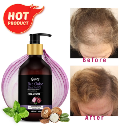 BUNEE® Hair Growth Shampoo
