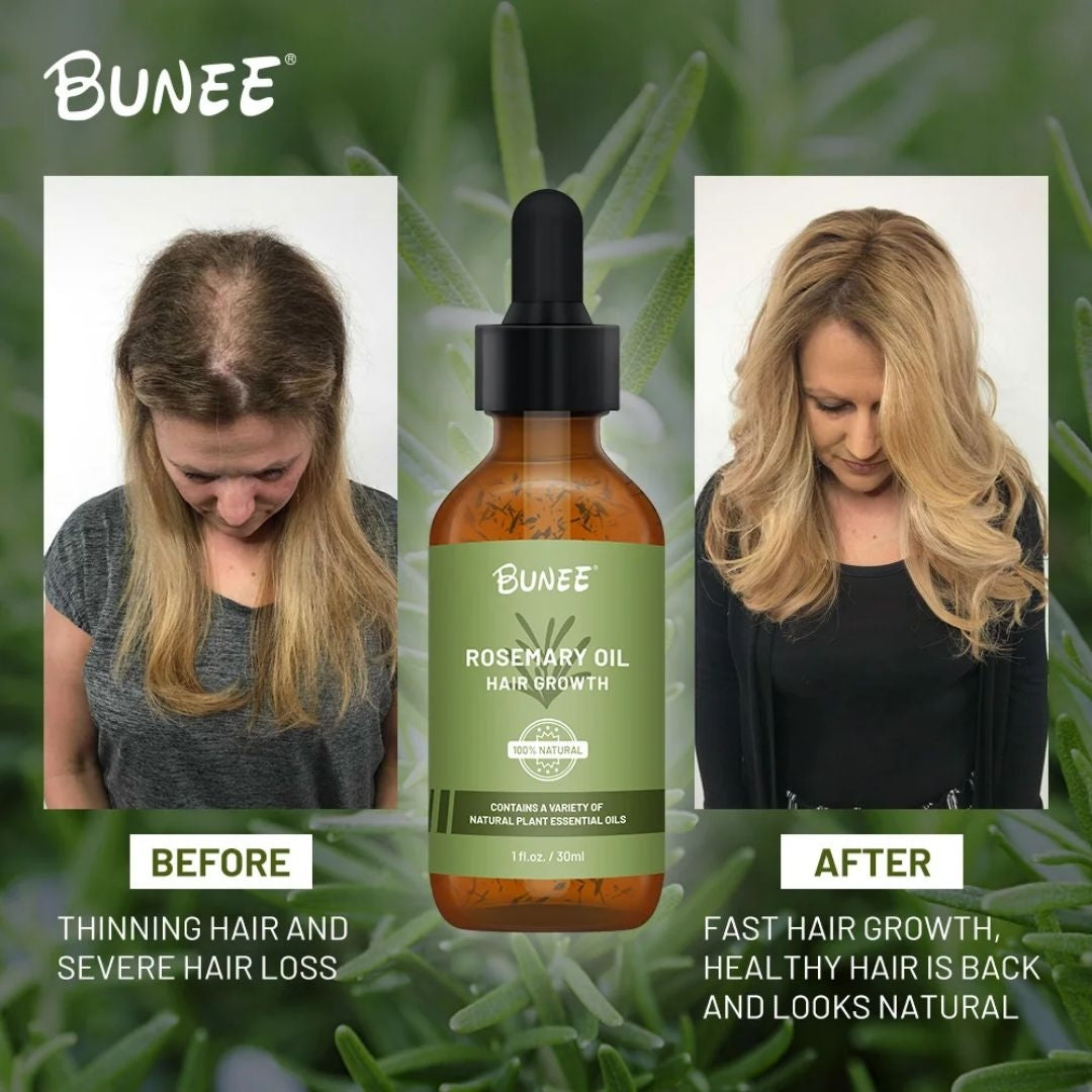 BUNEE® Hair Growth Serum