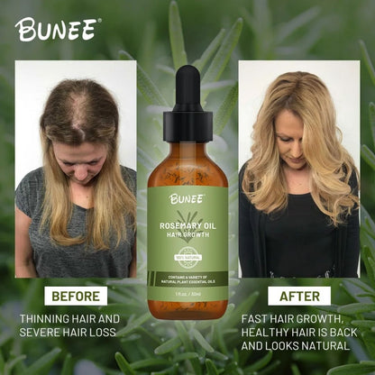 BUNEE® Hair Growth Serum