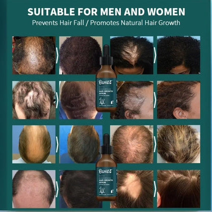 Hair Growth Serum