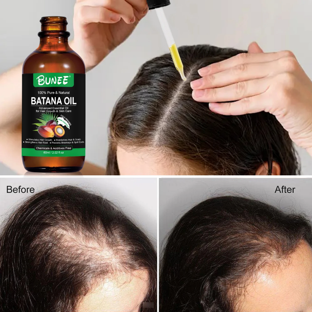 BUNEE® Batana Oil – Hair Growth Serum